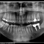 Πανοραμικό σύστημα I-MAX CEPH PRO