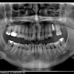 Πανοραμικό σύστημα CBCT I-MAX 3D CEPH PRO