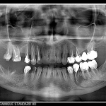 Πανοραμικό σύστημα CBCT I-MAX 3D PRO