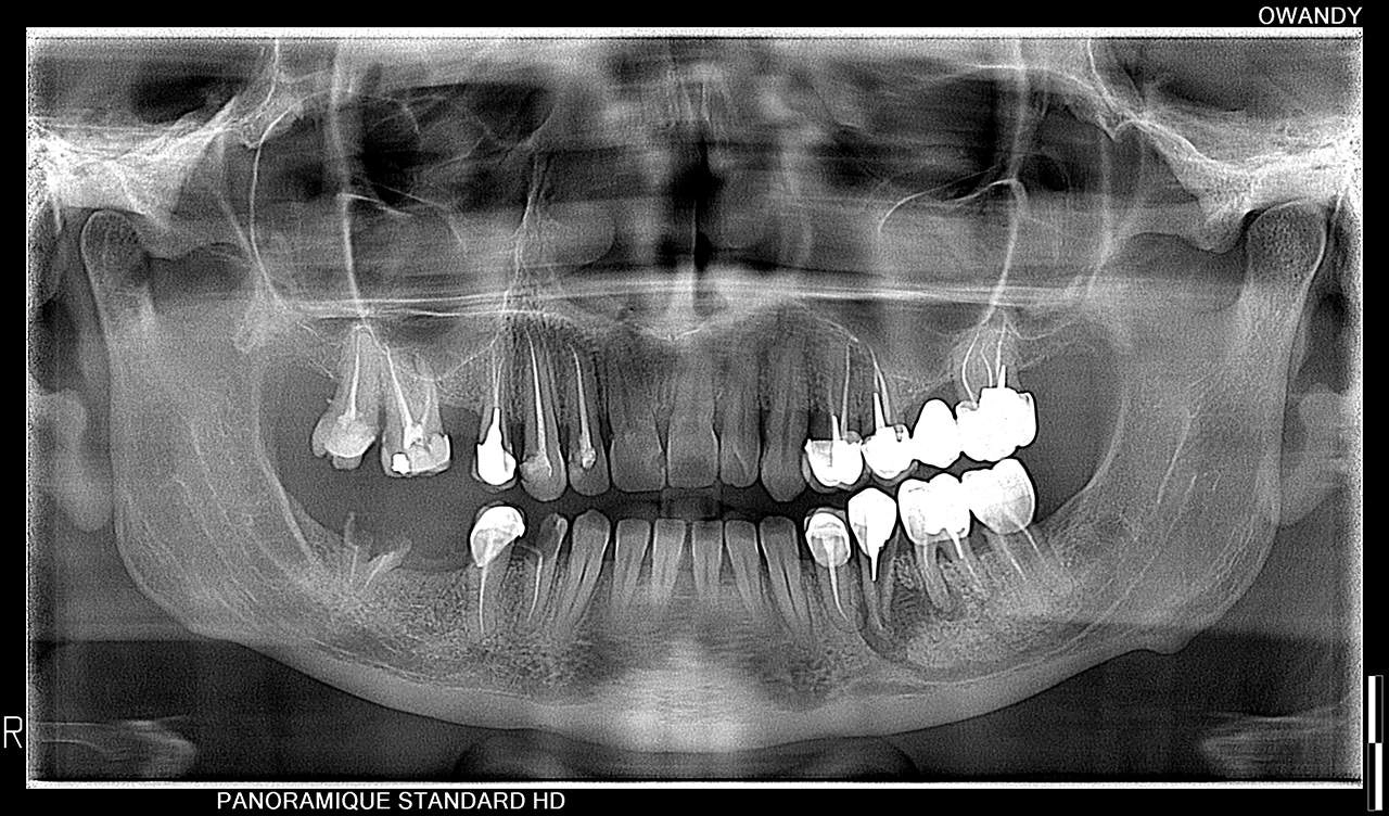 Πανοραμικό σύστημα CBCT I-MAX 3D PRO