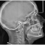 Πανοραμικό σύστημα CBCT I-MAX 3D CEPH PRO