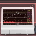 F15, Καρδιοτοκογράφος σύγχρονης τεχνολογίας