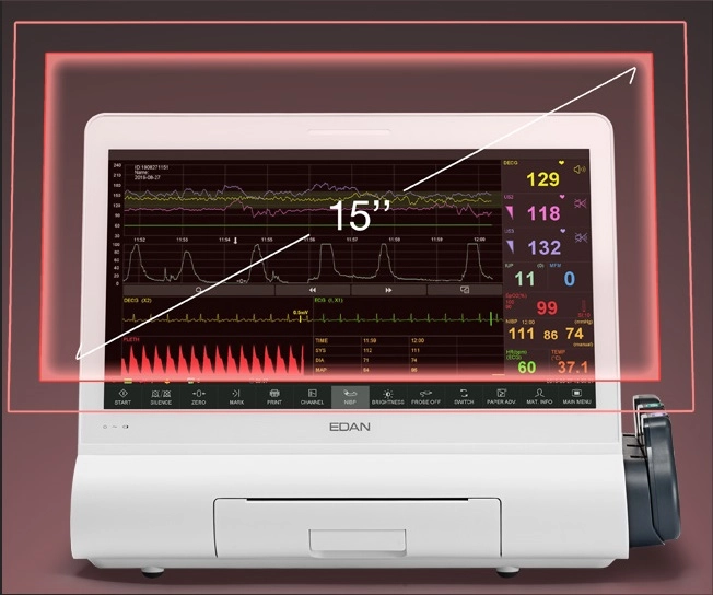 F15, Καρδιοτοκογράφος σύγχρονης τεχνολογίας