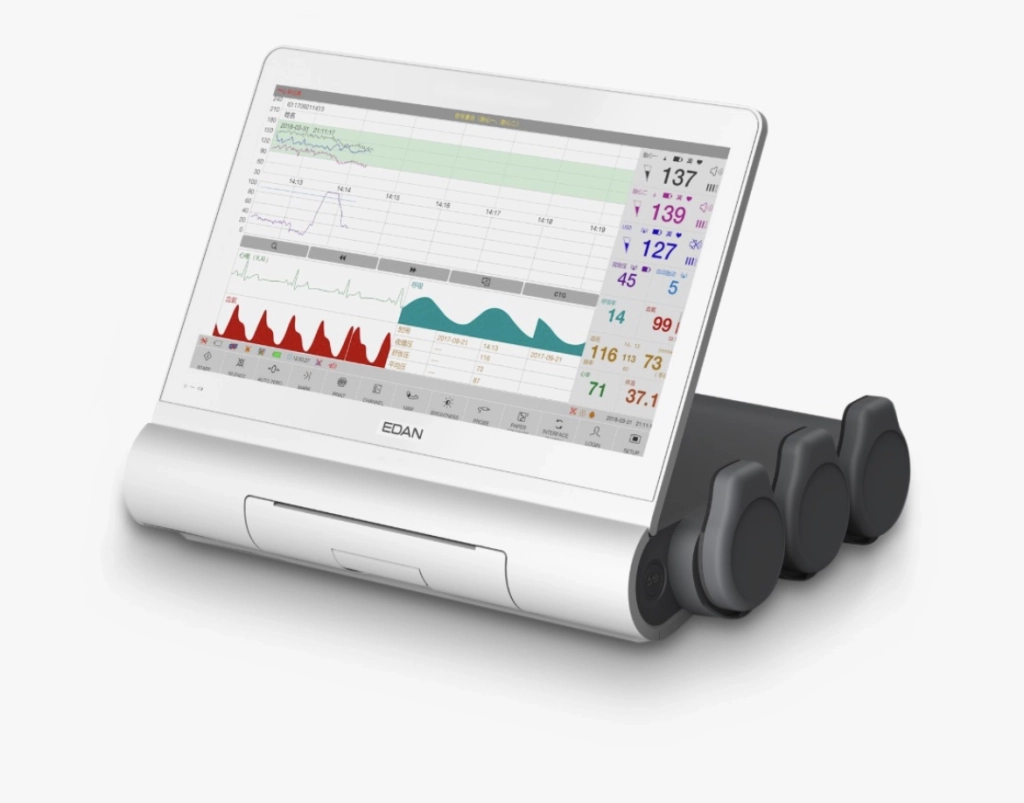 F15, Καρδιοτοκογράφος σύγχρονης τεχνολογίας