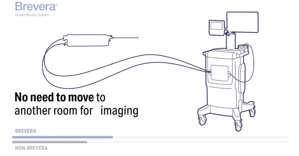 Πρώτη Εγκατάσταση του συστήματος βιοψίας μαστού BREVERA στην Αττική στο METROPOLITAN HOSPITAL