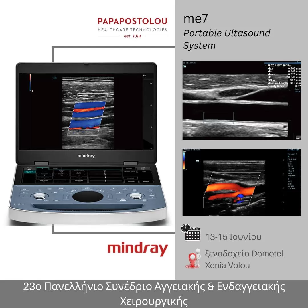 417459901_992293359567020_3511105926183110213_n