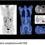 uMI Vista| Digital High-Resolution PET/CT