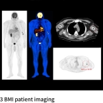 uMI Vista| Digital High-Resolution PET/CT
