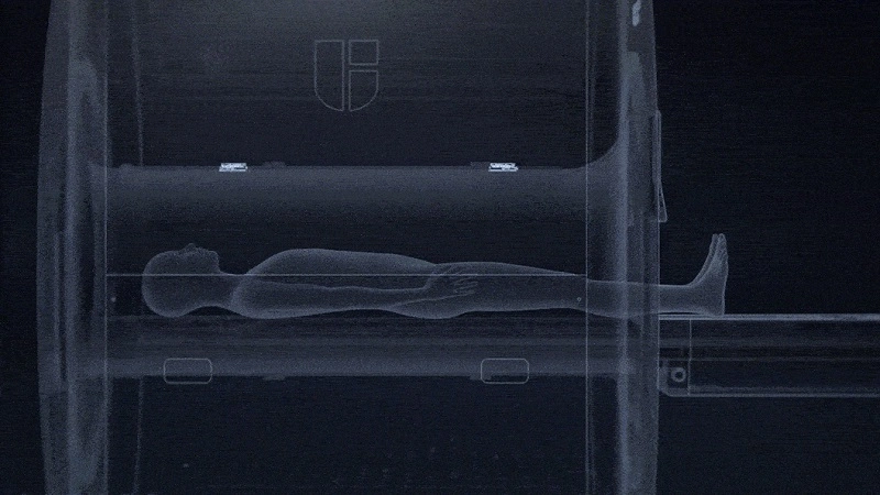 uMR 670 | 70cm Wide-Bore 1.5T MR