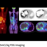 uMI Vista| Digital High-Resolution PET/CT