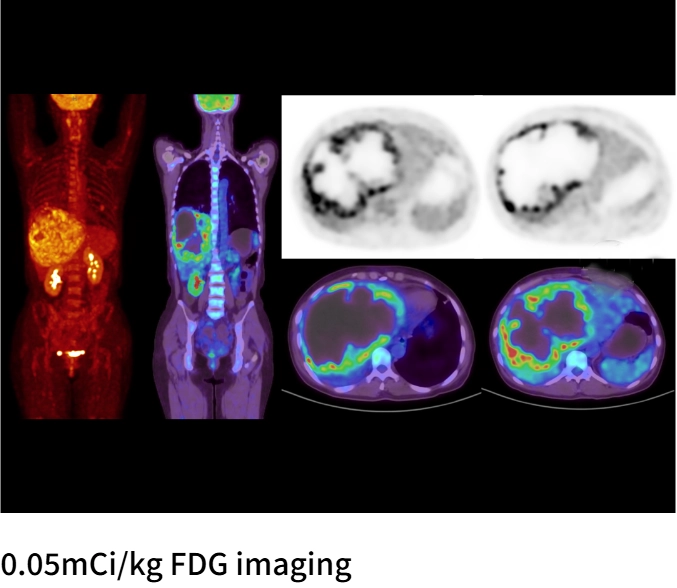 uMI Vista| Digital High-Resolution PET/CT