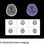 uMI Vista| Digital High-Resolution PET/CT
