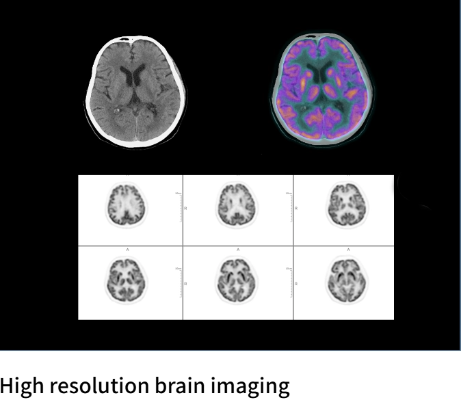 uMI Vista| Digital High-Resolution PET/CT