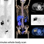 uMI Vista| Digital High-Resolution PET/CT
