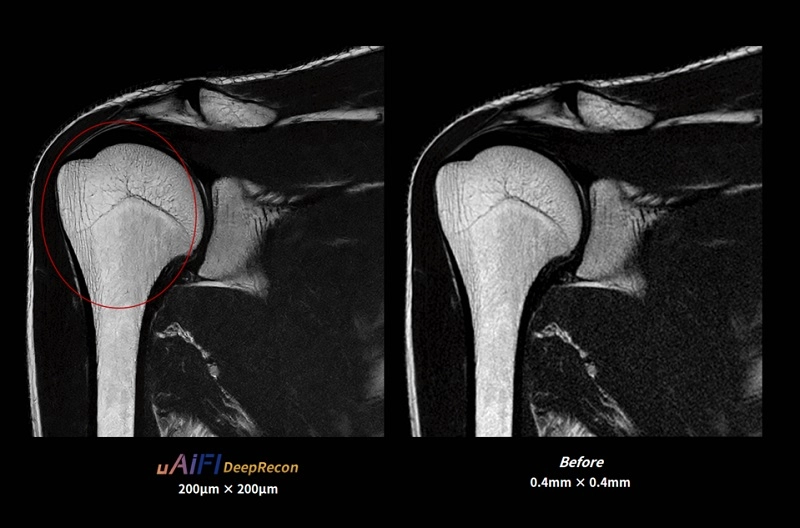 uMR 670 | 70cm Wide-Bore 1.5T MR