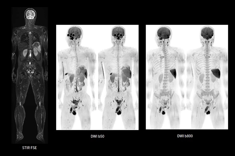 uMR 670 | 70cm Wide-Bore 1.5T MR