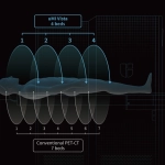 uMI Vista| Digital High-Resolution PET/CT