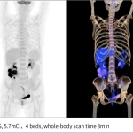 uMI Vista| Digital High-Resolution PET/CT