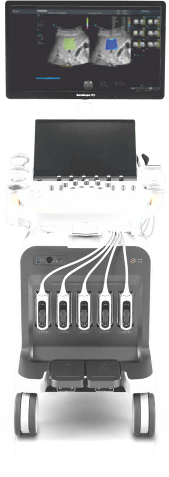 Υπερηχογράφος SonoScape S70i Marvo